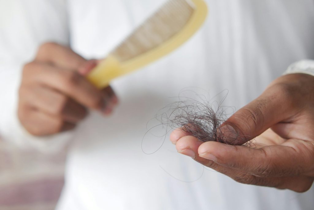 Person holding a comb and hair that has fallen out